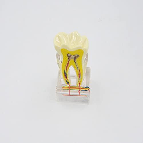 UCCE 6x заби анатомија модел модел на патологија модел на заби нерв настава анатомија модел на забна демонстрација медицинска